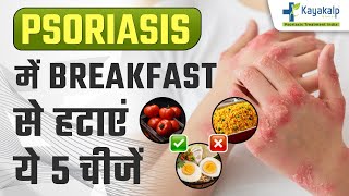 Psoriasis में इन 5 चीज़ो भूल कर भी ना खाये  Dont Eat These 5 Foods in Psoriasis  Kayakalp Global [upl. by Hersh]