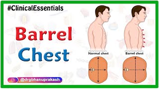 Barrel chest  Clinical essentials [upl. by Atikihs485]