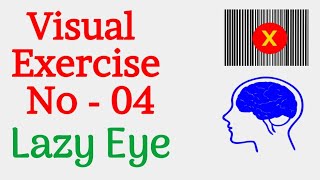 Lazy Eye Exercise 4 Amblyopia amp Strabismus। Best Eye Exercise [upl. by Jacobson]