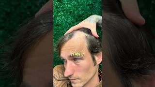 Stop Hairfall and REGROW hair naturally hairfallsolution hairlosstreatment [upl. by Tanner]