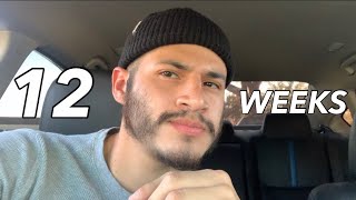 Week 12 Minoxidil Beard Growth Journey WEEKLY UPDATE [upl. by Scoter]