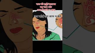 साइनसनाक की हड्डी बढ़ जाना । Sinus Treatment। Nak ki Haddi Ka Badha।sinuses sinusitistreatment [upl. by Dylan779]