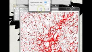 Quantifying Stained Liver Tissue Area Using ImageJ [upl. by Karie84]