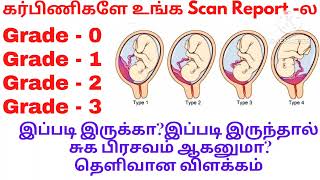 Placenta Grade 0placenta Grade 1 Grade 2Grade 3 என்றால் என்னPlacenta maturity grading in tamil [upl. by Airetnuhs]