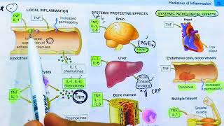 Cytokines and Chemokines Inflammatory mediators of inflammationTNF and InterleukinsRobbins patho [upl. by Omora]