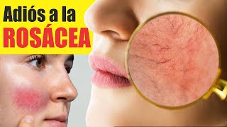 7 remedios naturales para curar rasguños en la piel [upl. by Juster]