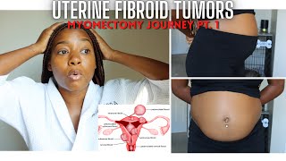 Massive Fibroid Tumors Journey  My Symptoms Diagnosis and PreOp MyomectomyCSection [upl. by Jojo]