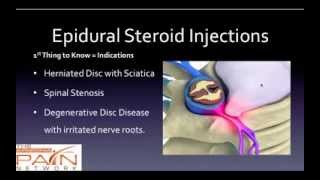 5 Things to Know About Epidural Steroid Injections 602 5076550 [upl. by Navis559]