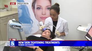 New Skin Tightening Treatment Exilis Ultra Face [upl. by Enileme293]