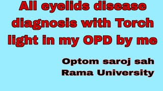 All diseases diagnosis with Torch light in my OPD eyelids disease  Optometrist Nepal [upl. by Lorenz603]