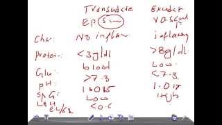 QUICK PATHOLOGY Transudate Vs Exudate pleural effusion [upl. by Kcirdla]