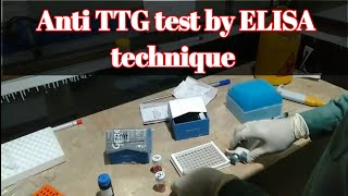 Procedure of Anti TTG tissue transglutaminase test IgG amp IgA by Elisa Technique [upl. by Sinnel900]