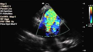 Patent Ductus Arteriosus in a dog [upl. by Ayamahs]