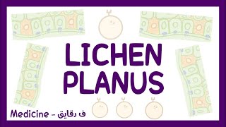 Lichen planus  definition pathophysiology types clinical picture diagnosis amp treatment شرح عربي [upl. by Anner]