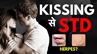 Can You Get STD From Kissing Kiss Karne Se Kaun Si Bimari Hoti Hai [upl. by Tolland546]