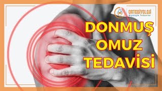 DONMUŞ OMUZ SENDROMU NEDİR [upl. by Demahum]