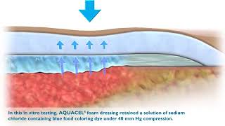 Why choose ConvaTec Aquacel Ag Foam Dressing with Adhesive Border [upl. by Nyer]