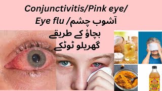 Conjunctivitis Causes symptoms and treatment of conjunctivitis [upl. by Lairret894]