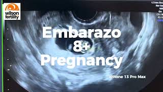 🤰 EmbarazoPregnancy 8 amp Corpus luteum [upl. by Holbrook]