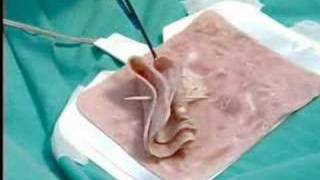 Endoscopia quotLa Historia no Contadaquot parte 6 67 [upl. by Marston]