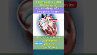 when do Echo after asd device closure l echo asd shorts [upl. by Ayhtin673]