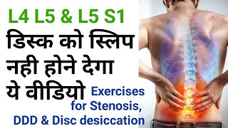 exercises for back pain Disc Dessication stenosis l4l5 l5s1 facet joint by dr sandeep Bhardwaj [upl. by Sinoda]