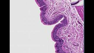 Histopathology Lung bronchus Cryptosporidium [upl. by Albertine]