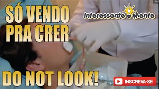 COMO É A RETIRADA DO TAMPÃO NASAL  RINOPLASTIA  SPLINT NASAL [upl. by Myrvyn249]