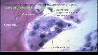 Learning Bone Growth 3 The Osteoclast [upl. by Urien672]