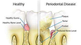 Introduction to Periodontology  Periodontics [upl. by Nomar529]