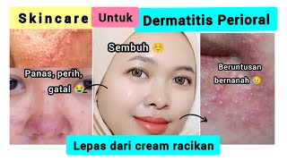 Perawatan saat Dermatitis Perioral Krim Dokter Veage Beaute  By Vapinka Makeup [upl. by Tamsky]