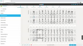 Charting the Odontogram [upl. by Ayouqat]