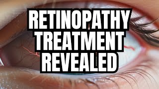 The BEST treatment for Diabetic Retinopathy [upl. by Parker]