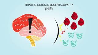 HypoxicIschemic Encephalopathy About Treatments amp Causes [upl. by Mirabelle]