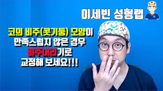 본인 코의 비주콧기둥 모양이 만족스럽지 않은 경우 비주내리기로 교정해 보세요  How to correct columellar retraction [upl. by Hoffert240]