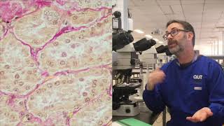 Microscope tutorial  Troubleshooting the Van Gieson stain [upl. by Trainor]