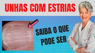 Estrias na Unha Saiba o Que Pode Ser [upl. by Eanehs]