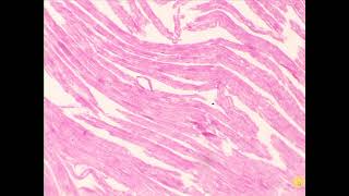 Cardiac muscle intercalated disc Heart [upl. by Kraft]