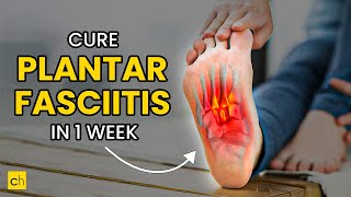 How To Cure Plantar Fasciitis in One Week  Credihealth plantarfasciitis exercise footpain [upl. by Aramanta]