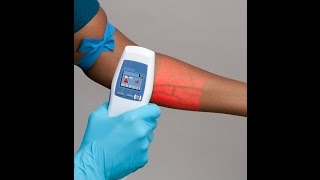 Accuvein AV400 vein finder جهاز طبي جديد للعثور على الأوردة [upl. by Shear]