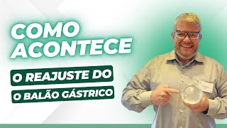 BALÃO GÁSTRICO COMO ACONTECE O REAJUSTE [upl. by Valentino]