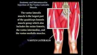 Cannulation How to gain IV access [upl. by Eniaj121]