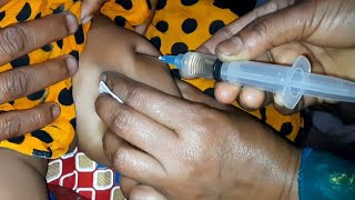 Ceftriaxone 500mg Trizon amp Dexamethasone injection im injection Video 24 Ep 25 By Injection Tips [upl. by Ivie833]