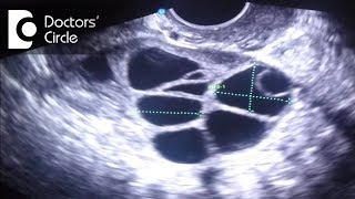 What do follicle size change in follicular study scan signify  Dr Teena S Thomas [upl. by Ennasirk]