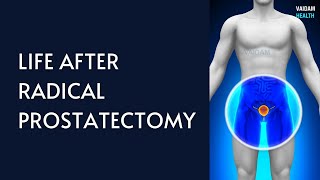 Life After Radical Prostatectomy [upl. by Aivila]