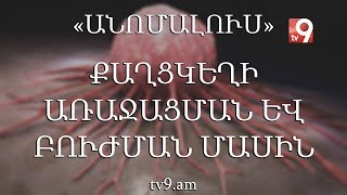 Քաղցկեղի առաջացման և բուժման մասին․ «Անոմալուս» Կարեն Եմենջյանի հետ։ [upl. by Aneleasor]