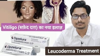 Vitiligo सफ़ेद दाग़ का नया इलाज़ 2024  Vitiligo New Treatment  Ruxolitinib  Leucoderma Treatment [upl. by Galvan243]