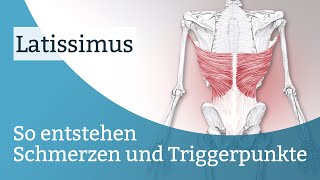 Latissimus Schmerzen Triggerpunkte und deren Aktivierung [upl. by Eirahs382]