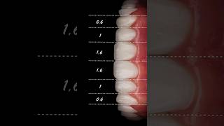 Every detail matters ✨🦷 cosmeticdentistry smiledesign shorts dentist [upl. by Nguyen]