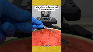 തണ്ണിമത്തൻ microscope ൽ വെച്ചപ്പോൾ [upl. by Niko]